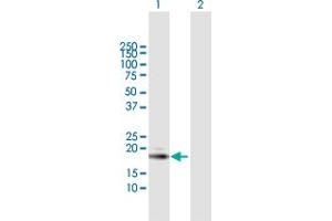 Image no. 2 for anti-Interferon Stimulated Exonuclease Gene 20kDa (ISG20) (AA 1-181) antibody (ABIN517237)