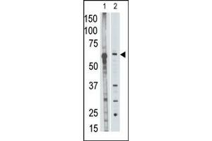 anti-Matrix Metallopeptidase 25 (MMP25) (AA 470-499), (C-Term) antibody