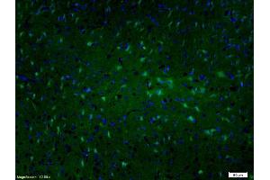 Image no. 1 for anti-Microtubule-Associated Protein 2 (MAP2) (AA 1-120) antibody (ABIN685567)