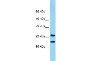 Image no. 1 for anti-NADH Dehydrogenase (Ubiquinone) 1 beta Subcomplex, 10, 22kDa (NDUFB10) (C-Term) antibody (ABIN2789282)