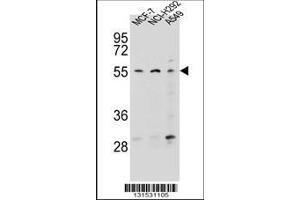 Image no. 1 for anti-Zinc Finger Protein 117 (ZNF117) (AA 13-41), (N-Term) antibody (ABIN656458)