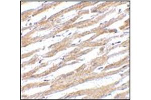 Image no. 2 for anti-CD274 (PD-L1) (Center) antibody (ABIN500467)