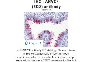 Image no. 1 for anti-Armadillo Repeat Gene Deleted in Velocardiofacial Syndrome (ARVCF) (AA 863-963) antibody (ABIN1723436)