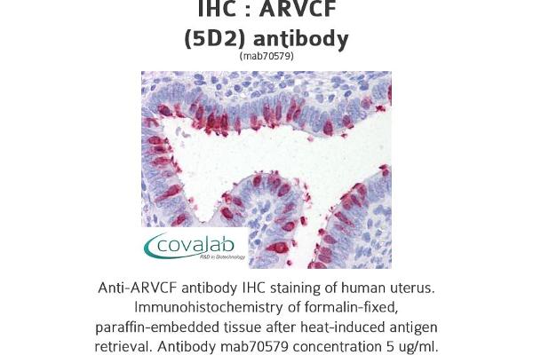 ARVCF Antikörper  (AA 863-963)