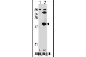 Image no. 3 for anti-Ubiquitin-Conjugating Enzyme E2I (UBE2I) (AA 1-30), (N-Term) antibody (ABIN387910)