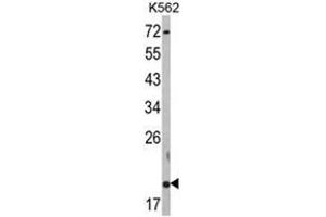 Image no. 1 for anti-Ring Finger Protein 5, E3 Ubiquitin Protein Ligase (RNF5) (N-Term) antibody (ABIN453813)