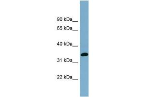Image no. 1 for anti-Acyl-CoA Wax Alcohol Acyltransferase 1 (AWAT1) (N-Term) antibody (ABIN2781957)
