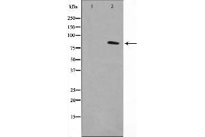 Image no. 1 for anti-Transforming, Acidic Coiled-Coil Containing Protein 1 (TACC1) antibody (ABIN6265428)