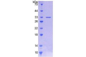 Image no. 1 for Cytochrome P450, Family 11, Subfamily A, Polypeptide 1 (CYP11A1) (AA 44-287) protein (His tag) (ABIN6238648)