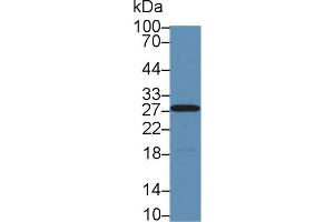 Image no. 2 for anti-Carbonic Anhydrase II (CA2) (AA 1-260) antibody (ABIN1173596)