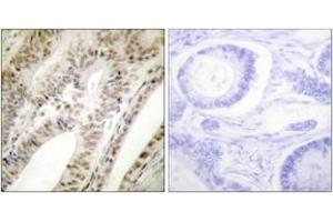 Image no. 2 for anti-Promyelocytic Leukemia (PML) (AA 11-60) antibody (ABIN1533381)