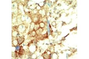 Image no. 1 for anti-Ret Proto-Oncogene (RET) (AA 1012-1042) antibody (ABIN3032460)