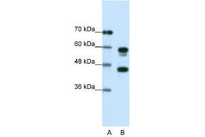Image no. 1 for anti-Proteasome (Prosome, Macropain) 26S Subunit, ATPase, 5 (PSMC5) (C-Term) antibody (ABIN925894)