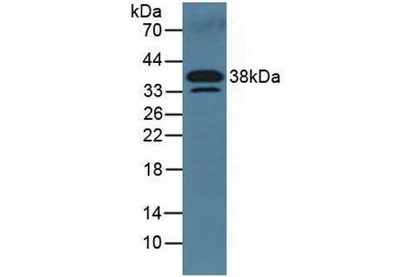 DKK3 Antikörper  (AA 23-349)