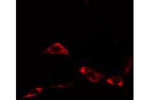 Image no. 3 for anti-Heat Shock Protein 90kDa alpha (Cytosolic), Class A Member 1 (HSP90AA1) (C-Term) antibody (ABIN6254913)