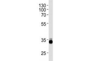 Image no. 3 for anti-Orthodenticle Homeobox 2 (OTX2) (AA 261-289) antibody (ABIN3032101)