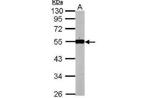 Image no. 2 for anti-Kruppel-Like Factor 12 (KLF12) (Center) antibody (ABIN2855792)
