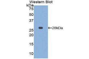 anti-Matrix Metallopeptidase 15 (Membrane-inserted) (MMP15) (AA 336-539) antibody