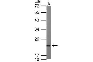 WB Image Sample (50 ug of whole cell lysate) A: mouse heart 12% SDS PAGE antibody diluted at 1:1000