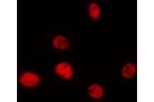 Image no. 1 for anti-Pre-mRNA Processing Factor 39 (PRPF39) (C-Term) antibody (ABIN6259332)