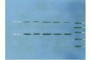 Image no. 2 for anti-Endothelial PAS Domain Protein 1 (EPAS1) (AA 1-130) antibody (ABIN686662)