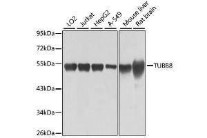 Image no. 1 for anti-Tubulin, beta 8 (TUBB8) antibody (ABIN6149690)