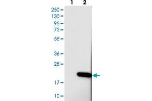 Image no. 2 for anti-PDZ Domain Containing 11 (PDZD11) antibody (ABIN5585477)