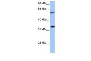 Image no. 1 for anti-Testis-Specific serine Kinase Substrate (TSKS) (AA 351-400) antibody (ABIN6738899)
