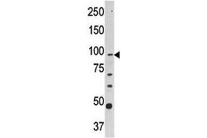 Image no. 1 for anti-Carnitine Palmitoyltransferase 1A (Liver) (CPT1A) (AA 606-636) antibody (ABIN3030281)