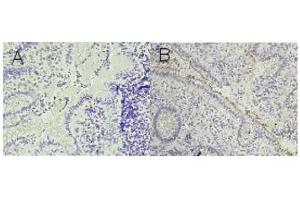 Image no. 4 for anti-Carcinoembryonic Antigen-Related Cell Adhesion Molecule 1 (Biliary Glycoprotein) (CEACAM1) antibody (ABIN108725)