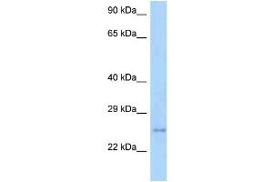 Image no. 1 for anti-TM2 Domain Containing 3 (TM2D3) (C-Term) antibody (ABIN2783970)