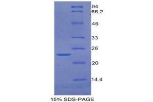 Image no. 1 for Growth Arrest-Specific 6 (GAS6) (AA 136-311) protein (His tag) (ABIN1877864)