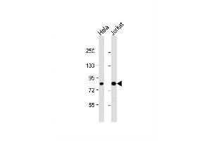 Image no. 2 for anti-conserved Helix-Loop-Helix Ubiquitous Kinase (CHUK) (AA 553-582), (C-Term) antibody (ABIN1881204)