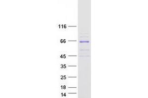 Image no. 1 for phosphoinositide Kinase, FYVE Finger Containing (PIKFYVE) (Transcript Variant 3) protein (Myc-DYKDDDDK Tag) (ABIN2729011)