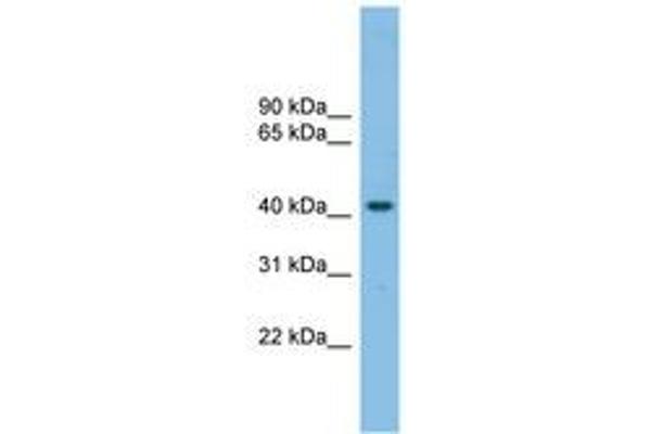 anti-G Protein-Coupled Receptor 87 (GPR87) (N-Term) antibody