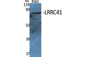 Image no. 2 for anti-Leucine Rich Repeat Containing 41 (LRRC41) (Internal Region) antibody (ABIN3185414)