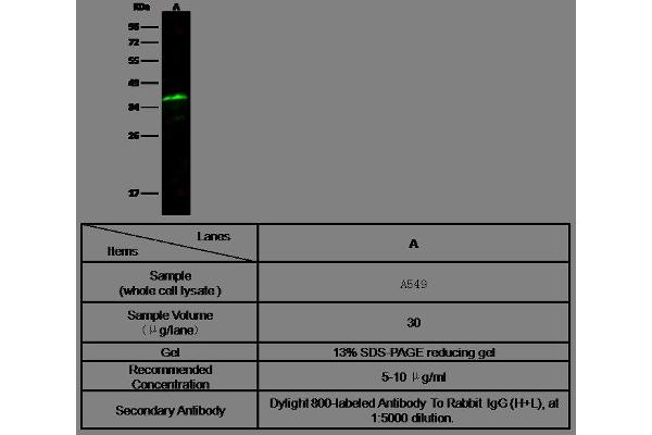 anti-Secreted Protein, Acidic, Cysteine-Rich (Osteonectin) (SPARC) (AA 1-302) antibody