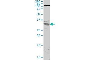 Image no. 1 for anti-Homeobox A11 (HOXA11) (AA 60-166) antibody (ABIN561322)