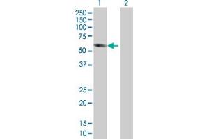Image no. 1 for anti-Dihydropyrimidinase-Like 5 (DPYSL5) (AA 1-564) antibody (ABIN527988)