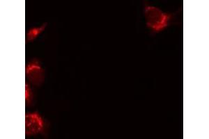 Image no. 2 for anti-Tumor Necrosis Factor Receptor Superfamily, Member 11b (TNFRSF11B) (Internal Region) antibody (ABIN6265637)