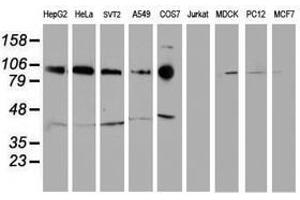 Image no. 1 for anti-Cadherin 2 (CDH2) antibody (ABIN1499626)