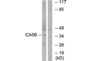 Image no. 1 for anti-Carbonic Anhydrase VB, Mitochondrial (CA5B) (AA 241-290) antibody (ABIN1534729)