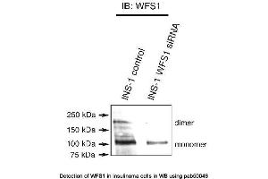 Image no. 1 for anti-Wolfram Syndrome 1 (WFS1) (N-Term) antibody (ABIN2852027)