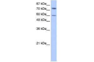 anti-Insulin-Like Growth Factor 2 mRNA Binding Protein 1 (IGF2BP1) (N-Term) antibody