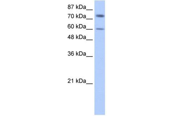 anti-Insulin-Like Growth Factor 2 mRNA Binding Protein 1 (IGF2BP1) (N-Term) antibody