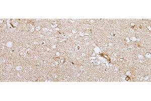 Immunohistochemistry of paraffin-embedded Human brain tissue using HOXC9 Polyclonal Antibody at dilution of 1:35(x200)
