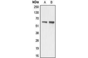 Image no. 3 for anti-Apoptosis Antagonizing Transcription Factor (AATF) (N-Term) antibody (ABIN2707295)