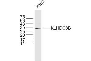 Image no. 1 for anti-Kelch Domain Containing 8B (KLHDC8B) (AA 201-300) antibody (ABIN5675546)