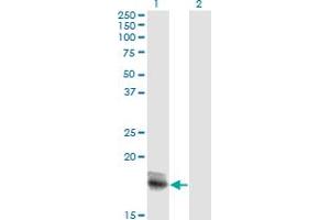 Image no. 1 for anti-Interleukin 15 (IL15) (AA 49-162) antibody (ABIN517140)