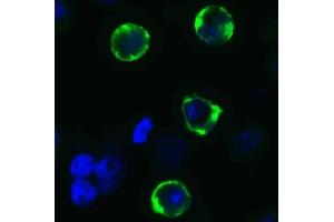Immunofluorescence (IF) image for anti-SARS-CoV-2 Spike antibody (ABIN6952962)